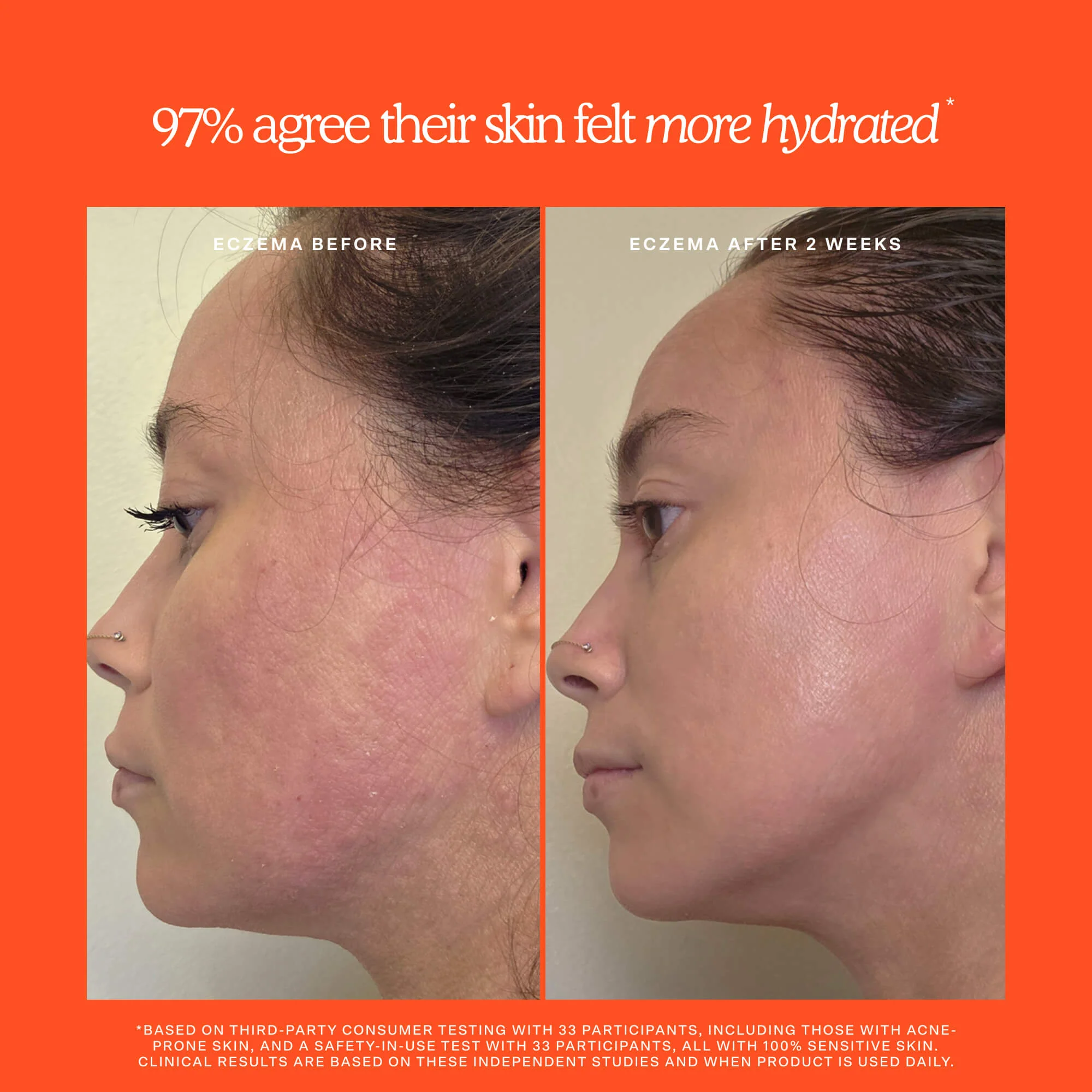 PROBLEM-SKIN_3_1